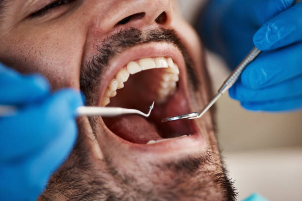 Oral Cancer Screening in Macungie, PA